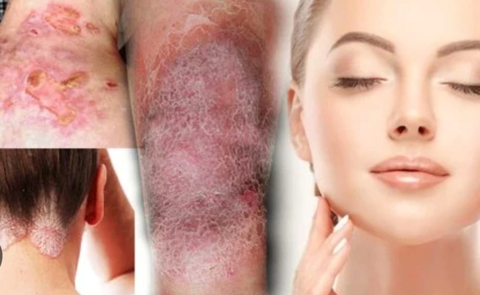 Certificate Programme in Ayurvedic Dermatology (CAD) Batch-5
